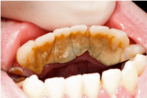 - Gulf Cove Dental