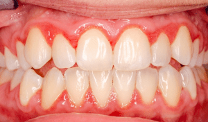 - Gulf Cove Dental