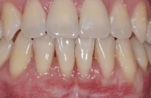 - Gulf Cove Dental