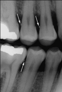 - Gulf Cove Dental